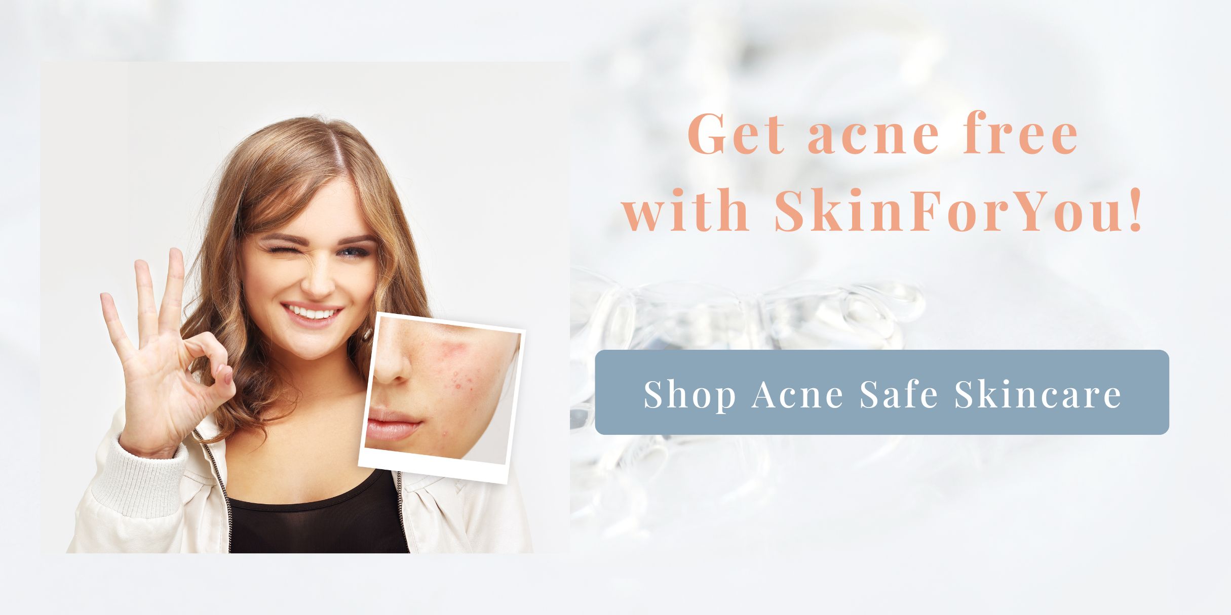https://skinforyou.com/store/shop/?filter=1&skin_concerns=acne